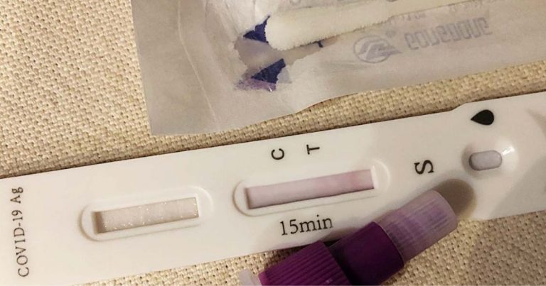 Un tampone antigenico fai da te